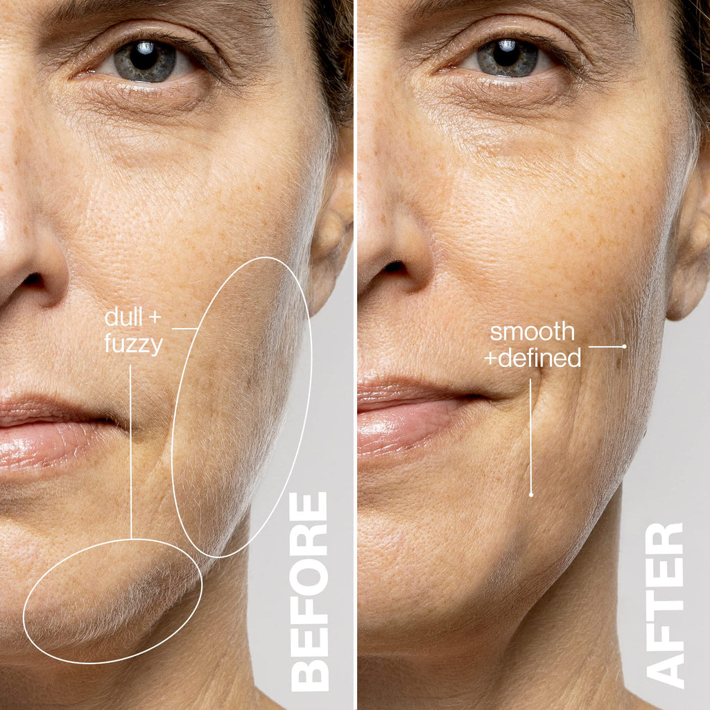 DERMAFLASH LUXE+ Sonic Dermaplaning Tool for Face Peach Fuzz Removal, Anti-Aging and Exfoliation, Stone