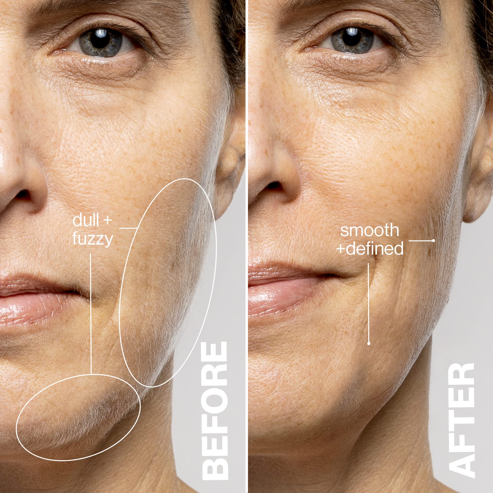 DERMAFLASH LUXE+ Sonic Dermaplaning Tool for Face Peach Fuzz Removal, Anti-Aging and Exfoliation, Stone